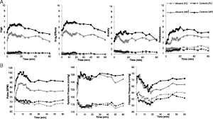 Decreased Dopamine Brain Reactivity In Marijuana Abusers Is