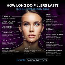 how long do fillers last the