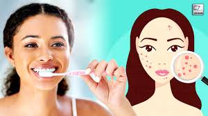 brushing after shower causes acne