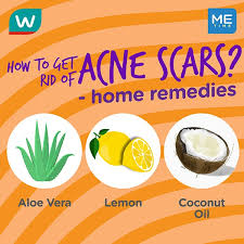 how to get rid of acne scars treatment