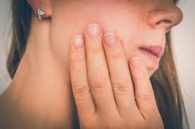 Direct applications of honey several times a day to each sore can help reduce the number of days of pain, as well as ulcer size and redness. What Causes Canker Sores Symptoms Causes And Treatments