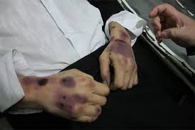 Картинки по запросу киев пытки ООН картинки