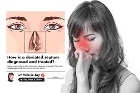 If your nasal septum is deviated, surgery provides the most lasting and effective solution. What Is A Deviated Septum And How Can It Be Fixed