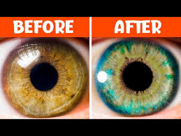 10 things that change your eye color