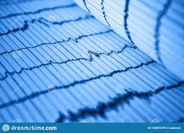 Sinus Heart Rhythm On Electrocardiogram Record Paper Showing