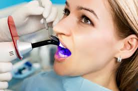 Can Dental Bonding Be Removed? - Olentangy Modern Dental