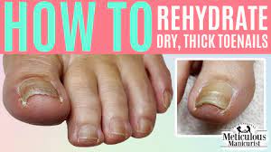 how to rehydrate a dry thick toenail