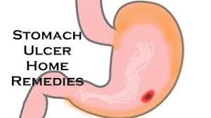 how to cure stomach ulcer home