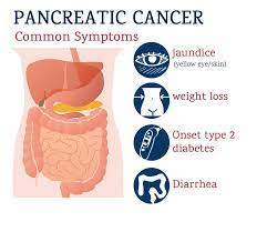Located behind the spine, your pancreas if you have jaundice, your stool will also be light, your urine becomes dark, and your skin will feel itchy. Pancreatic Cancer Treatment In Punjab Pancreatic Cancer Treatment Cost In Ludhiana