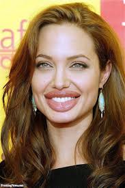 which singer had the biggest lips post