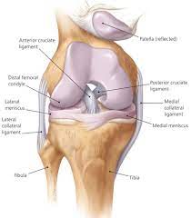 knee ligament injury