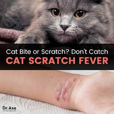 cat scratch fever see your doctor