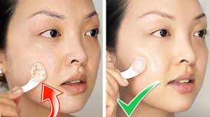 how to get clear complexion overnight