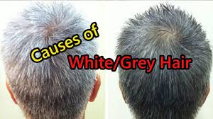 what causes white hair at early age in
