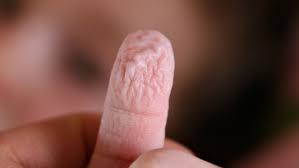 our fingers and toes wrinkle when wet