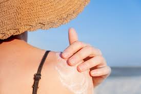 how to treat sunburn fast 13 at home