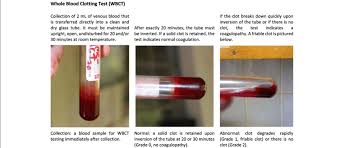 whole blood clotting test wbct