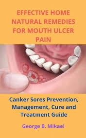 natural remes for mouth ulcer pain