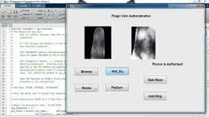 vein pattern recognition