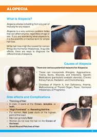 what is alopecia hair loss types