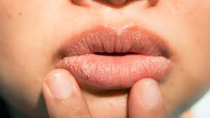 dry mouth at night causes symptoms
