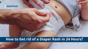 home remes for diaper rash