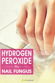 Hydrogen peroxide can be used to remove it. Hydrogen Peroxide Treatment For Nail Fungus Nailstip
