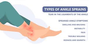 ankle injury using sprain ankle treatment