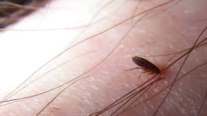 do fleas bite humans pestseek