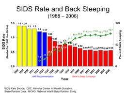 Sudden Infant Death Syndrome Wikipedia