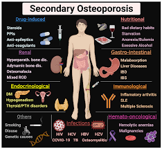secondary osteoporosis