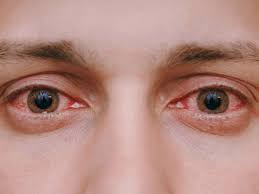 indications of eye problems signs