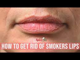 how to get rid of smokers lips you