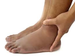 things your swollen feet and ankles