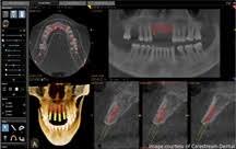 cone beam 3d ct scan fms dental hospital