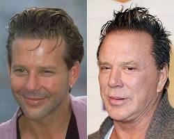Imagen de Mickey Rourke before and after plastic surgery