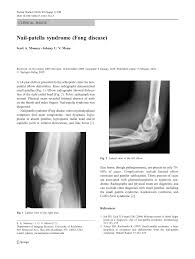 pdf nail patella syndrome fong disease