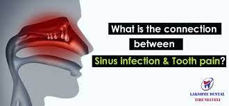 Sleeping position, tips and remedies… this article covers everything you need to know for a better sleep. Sinus Infection Tooth Pain Sinus Toothache