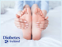 caring for your feet diabetes ireland