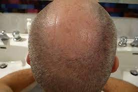 bald man s hair better than a barber