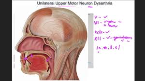 unilateral upper motor neuron