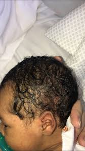 The researchers were able to identify the pattern of a black hole's ringing, and, using einstein's equations. Biracial Baby Hair April 2018 Babies Forums What To Expect