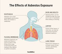 It causes the improvement of scar tissue in the lower flaps of the two lungs, which prompts minor cuts and worn out injuries in the texture. What S The Link Between Asbestos And Lung Cancer