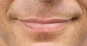 dry lips male grooming query