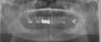 dental ct scan vs cone beam ct an