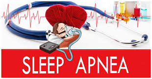 4 Things Veterans Should Know About Va Sleep Apnea