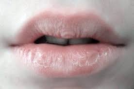 itchy lips causes and prevention vinmec