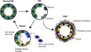 Kidney Tubule Basement Membrane An