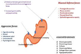 Pharmacotherapy Of Peptic Ulcer Disease And Latest Research