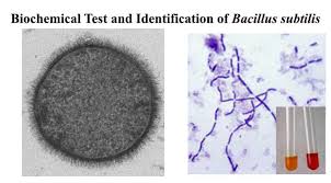 Biochemical Test And Identification Of Bacillus Subtilis